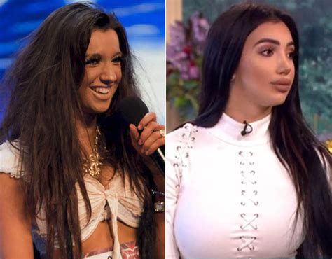 chloe khan before surgery|chloe khan before and after photos.